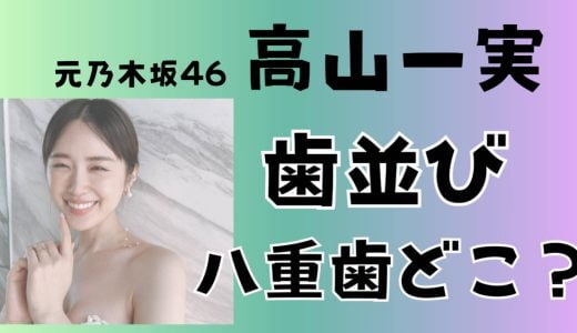 高山一実の歯並びが綺麗!マウスピース歯科矯正で八重歯の変化を過去と現在の画像比較